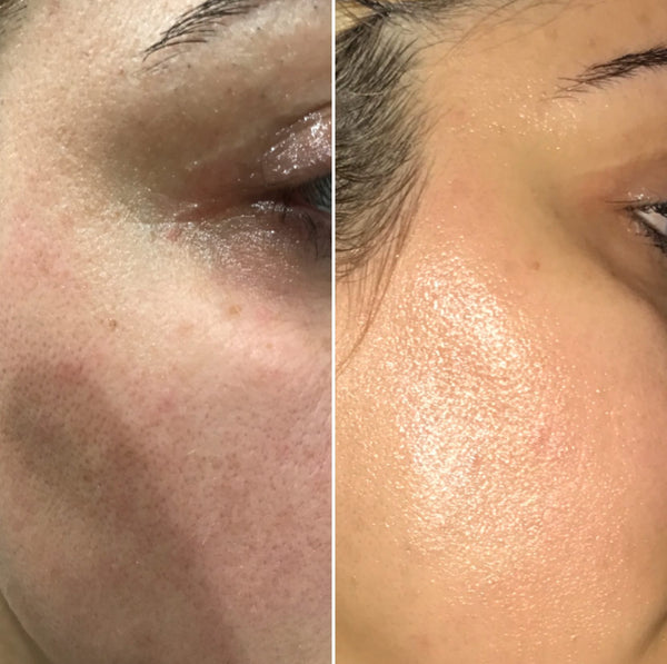 Before and After using facial oil reducing fine lines and wrinkles