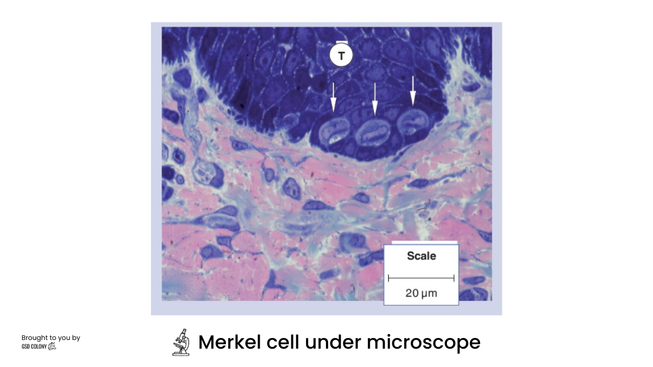 Merkel cell under microscope - GSD Colony