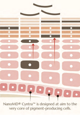 NanoMD® CyntraTM si designed at aim to the very core of pigment-producing cells.