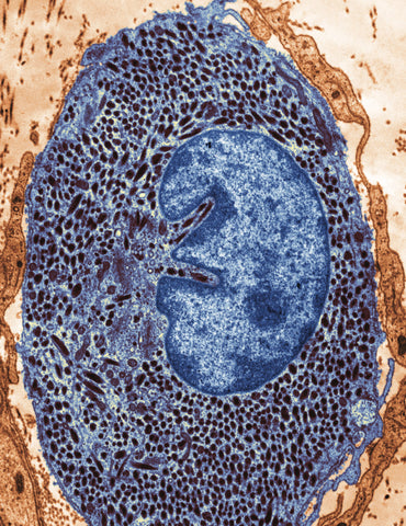 Color-enhanced transmission electron micrograph of a pigment cell. The melanocyte in the image is in the connective tissue and its cytoplasm is crowded with melanosomes.