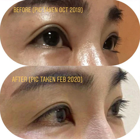 AnteAGE MD Overnight Lash Serum Before After