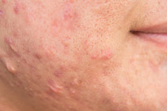 Congested Skin