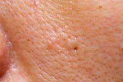 Large Pores