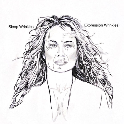 Sleep Wrinkles Sleep Lines vs Expression Lines