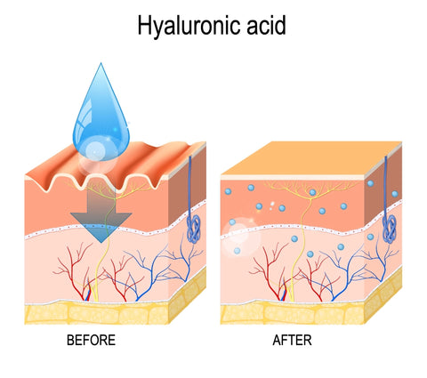 Hyaluronic acid shown how it works using a illustration