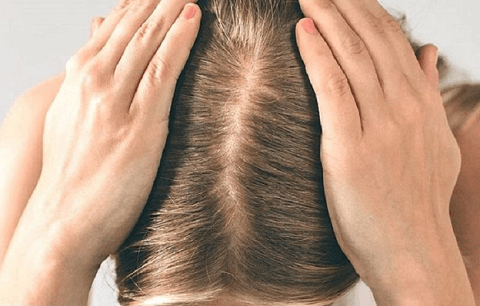 Keep Your Scalp Healthy