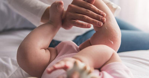 massage shea butter on baby for eczema