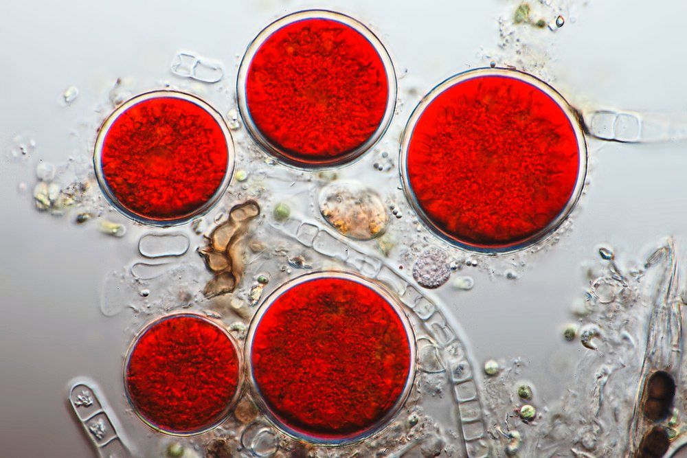 H. pluvialis microalgae, whose cells are seen here under a microscope, is used to make astaxanthin supplements due to their naturally-high bioavailability of this antioxidant. — Wikimedia Commons