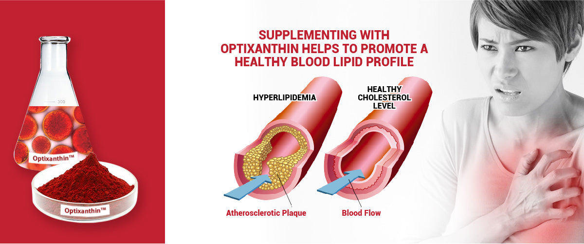 Optixanthin Astaxanthin helps to promote a healthy blood lipid profile