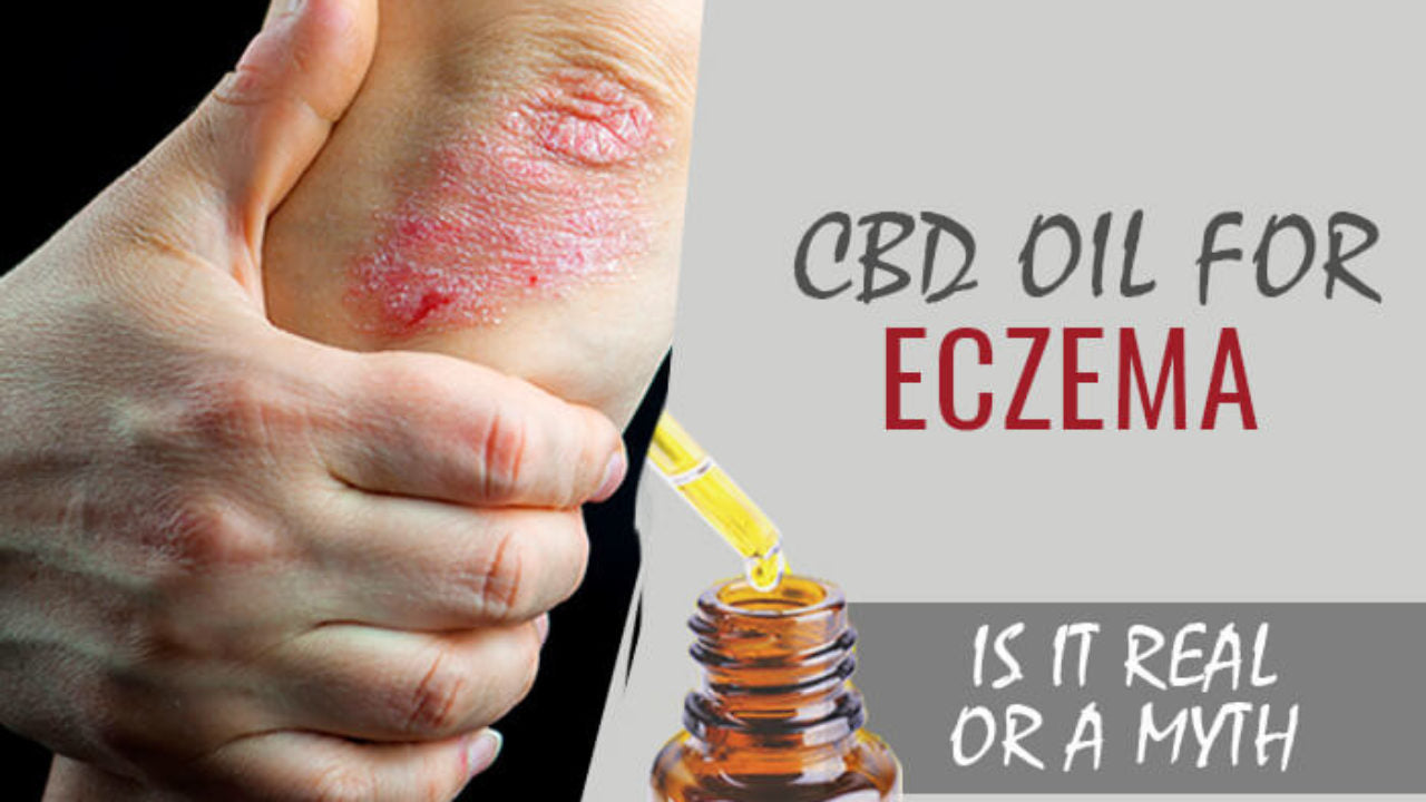 eczema cbd cream