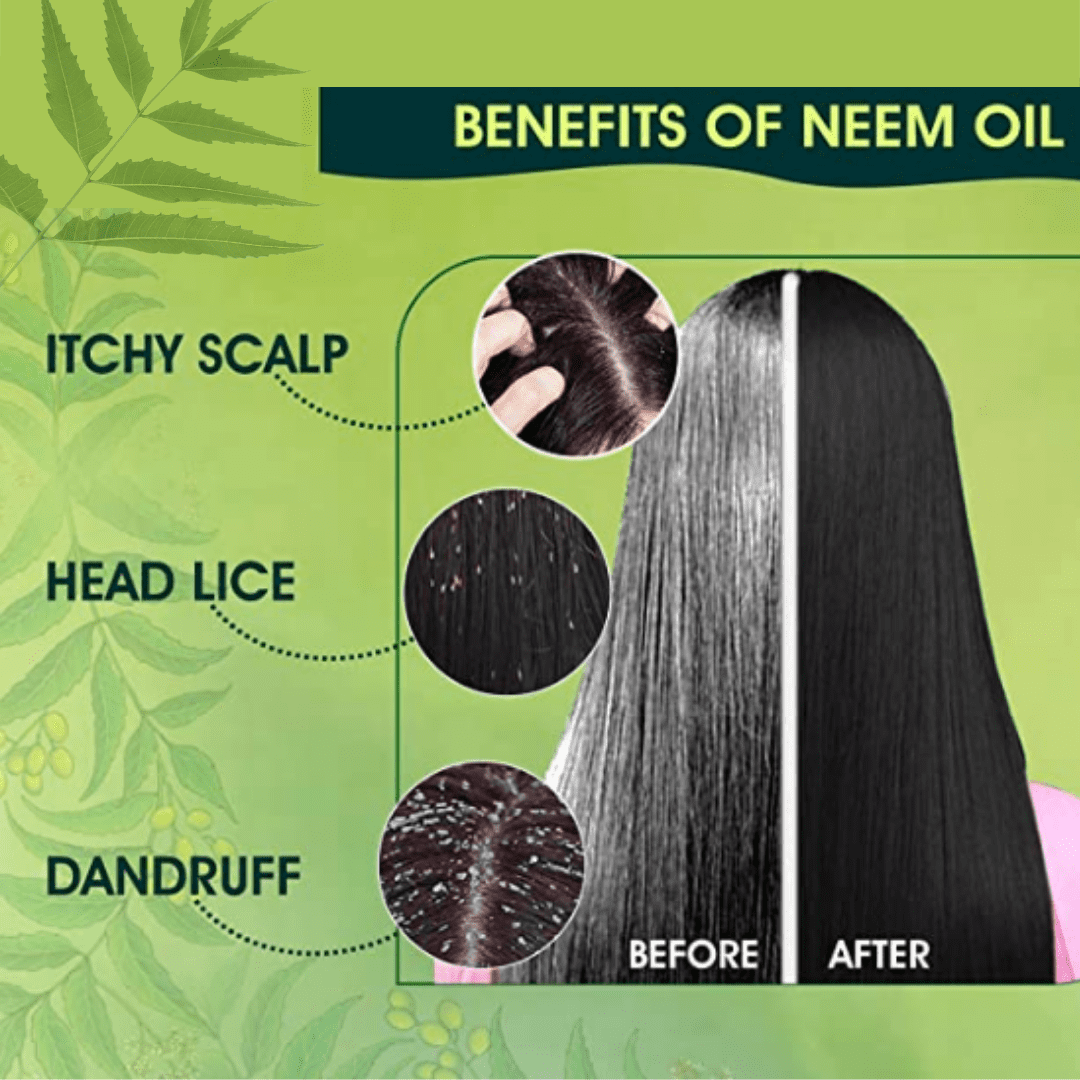 7 Amazing Benefits Of Neem Oil For Common Hair Problems  Krishnas Herbal   Ayurveda