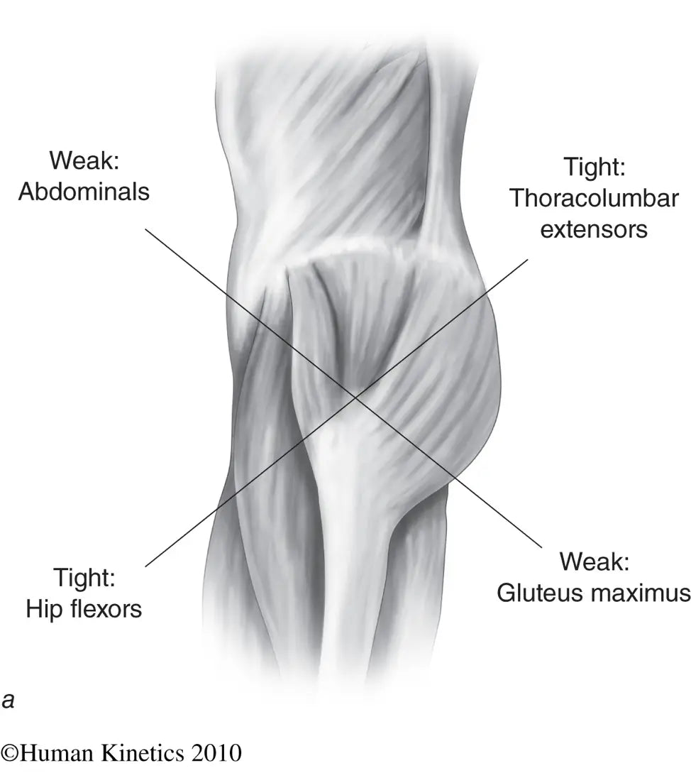 Gluteus Maximus - Physiopedia