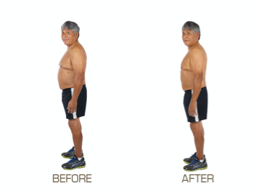 before and after side view of grey haired man in black shorts