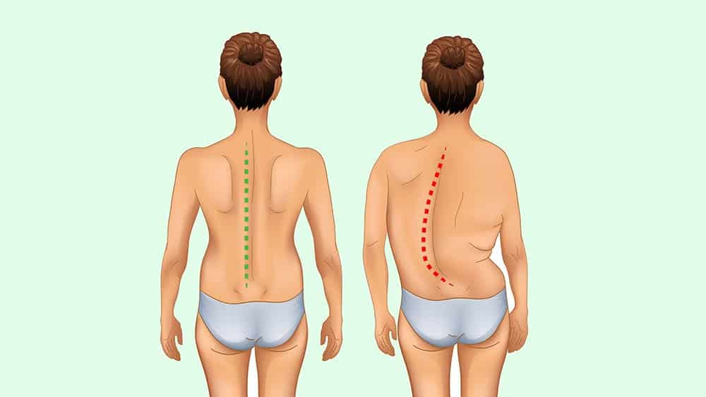 Semelles Orthopédiques Ajustable