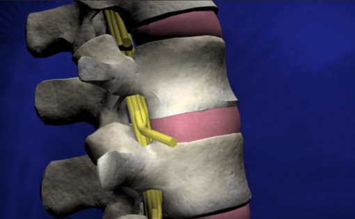spinal spine uncompressed healthy