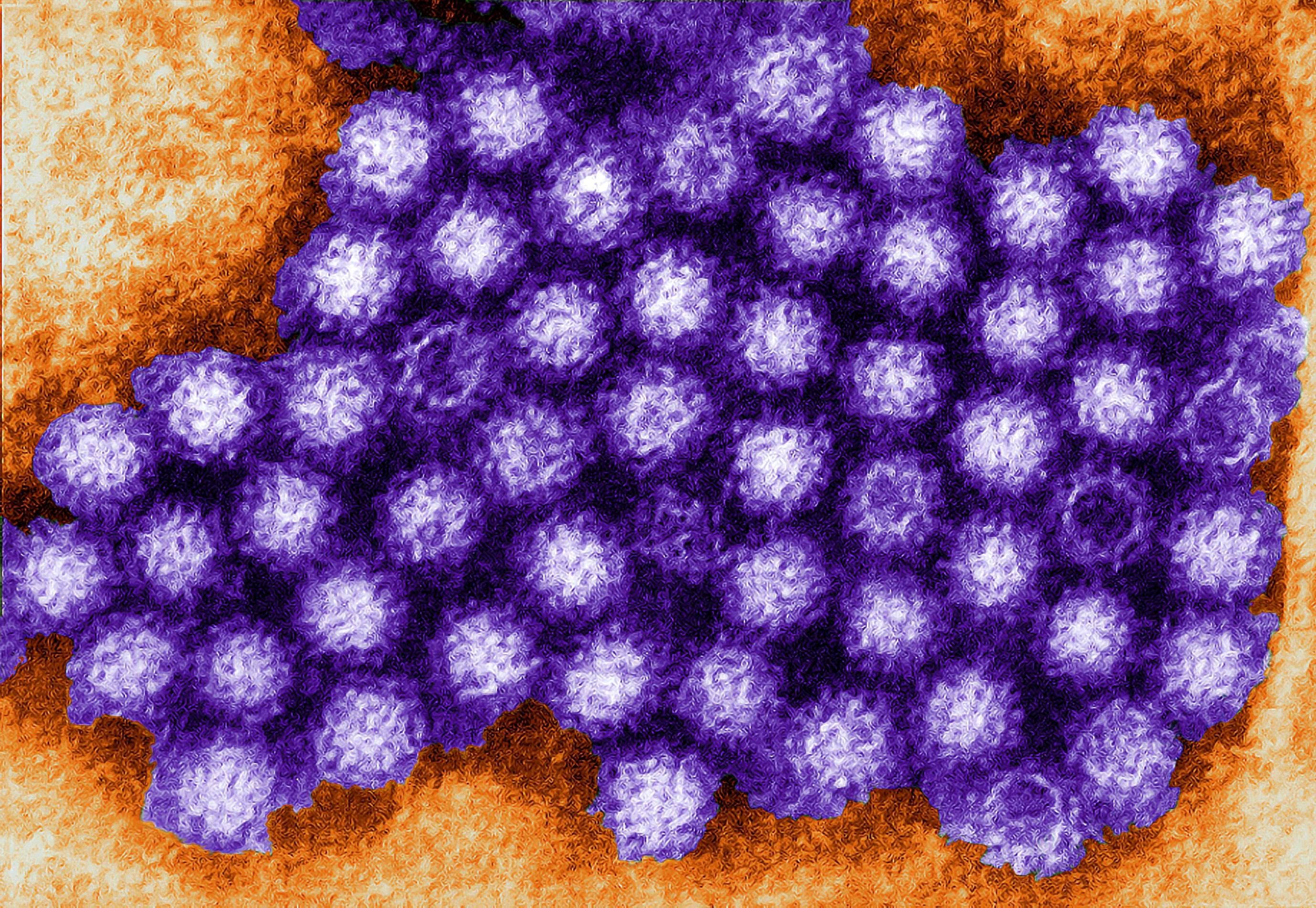 Norovirus