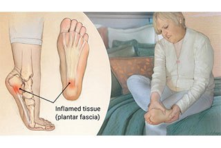 Fit My Feet - Foot Pathologies - Start Your Journey Today