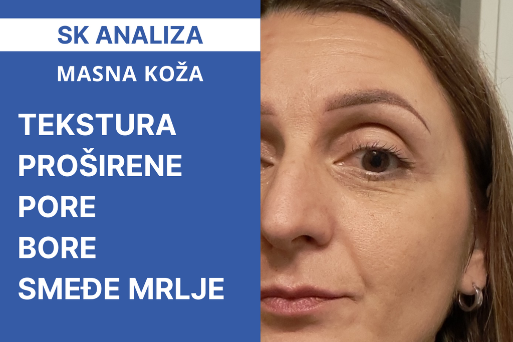 Analiza kože na stvarnom primjeru