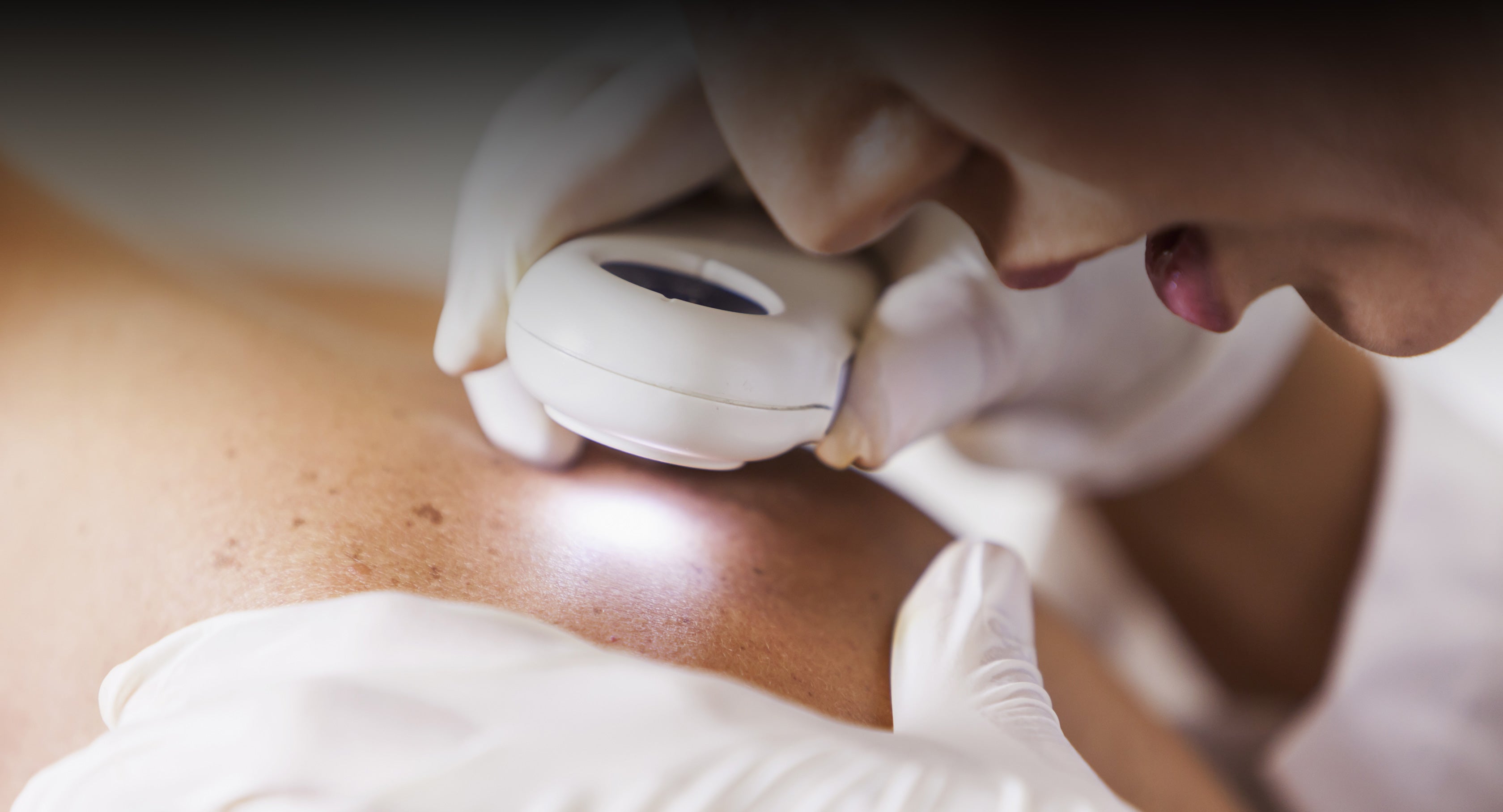 Ultrasonic Cavitation - Skin Lab Beauty Clinic