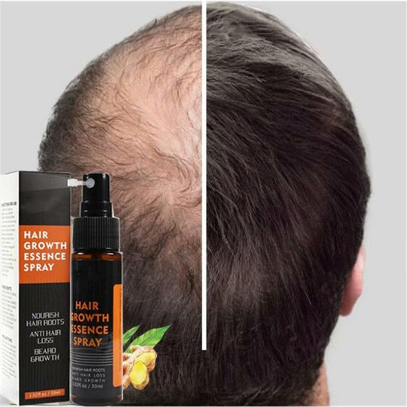 Спрей для волос для мужчин. Сыворотка Huoing hair growth Essence. Китайская эссенция hair growth Spray. Спрей для роста волос для мужчин. Hair Essence Spray.
