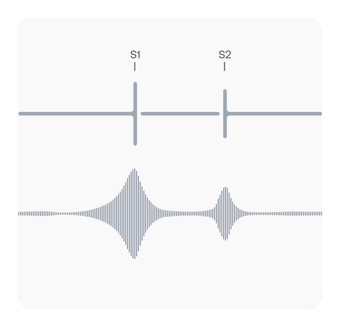 Simplified PCG Graphic