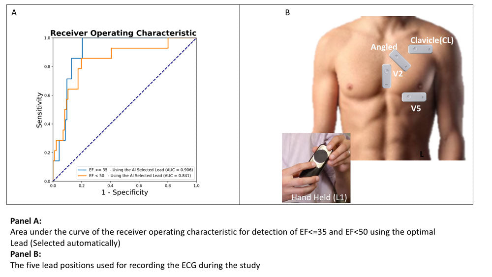 Data from MDP178 - Prospective Analysis of Utility of Signals From an ECG