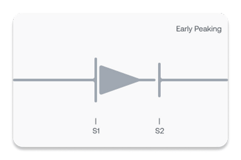 Showing graphic that represents early systolic murmurs