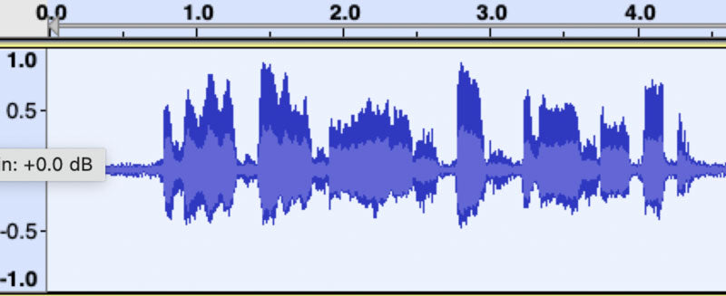 Heart Sound Waveform