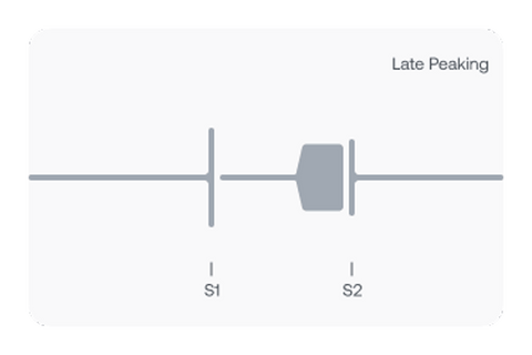 Graphic showing late systolic murmurs begin during the latter half of systole and extends to S2