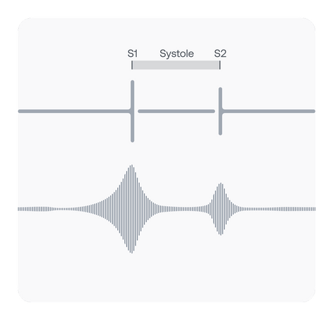 PCG Systole Graphic