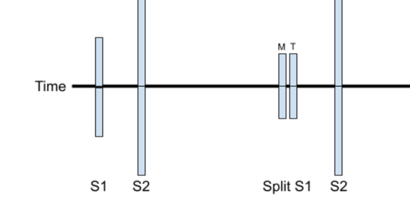 Upper panel - A depiction comparing normal heart sounds (S1/S2) to a split S1 (M = mitral, T = tricuspid).