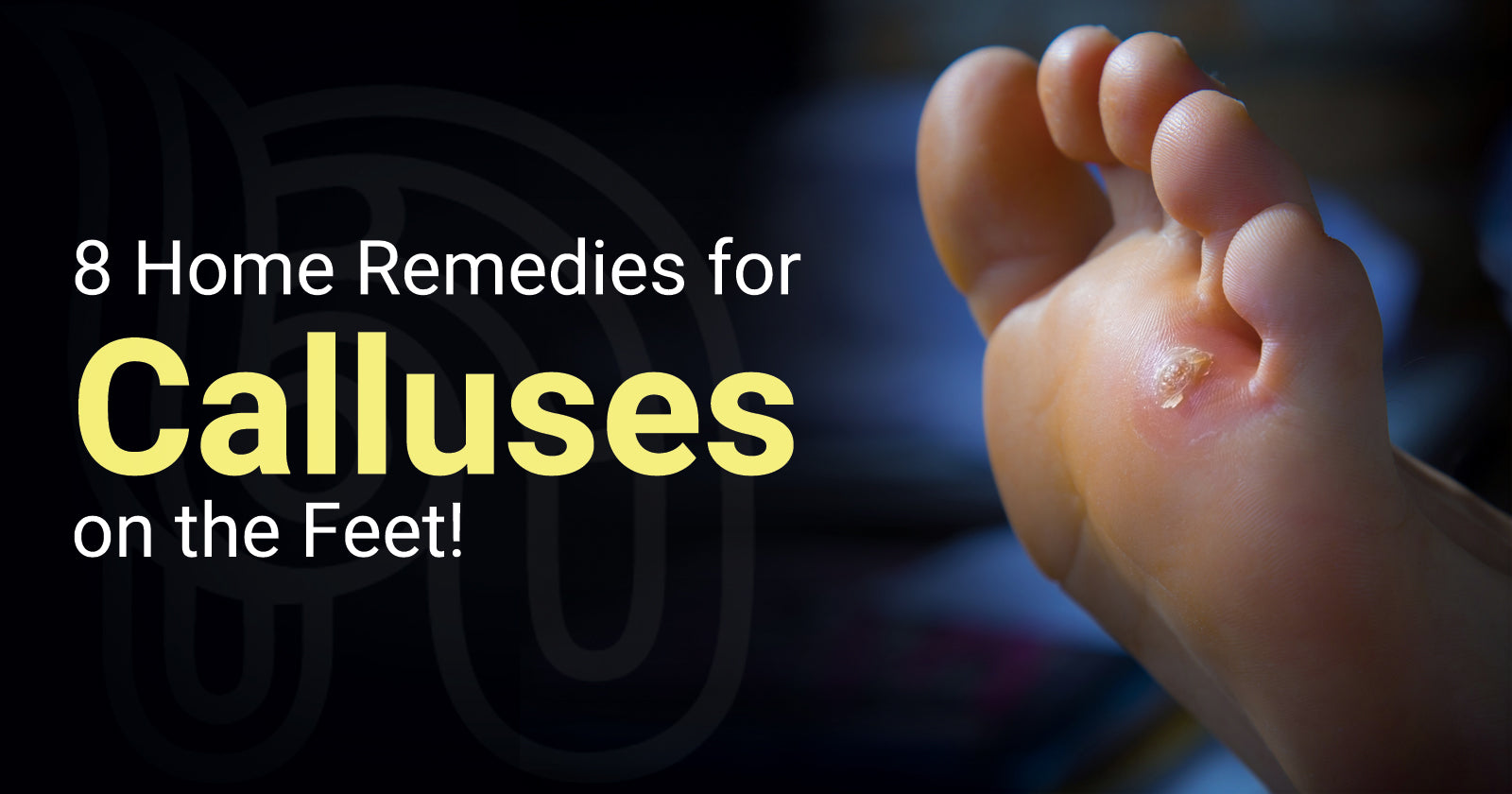home remedies for dry callused feet