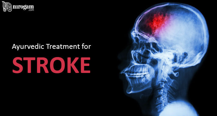 Ayurvedic Treatment for Stroke | Effective Home Remedies & Medication ...