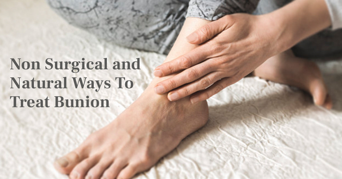 Natural Ways To Treat Bunion