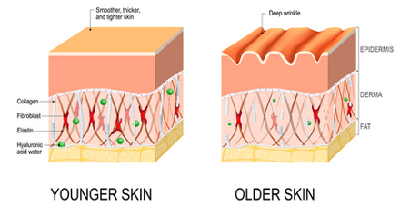 Wrinkles on skin collagen deficiency