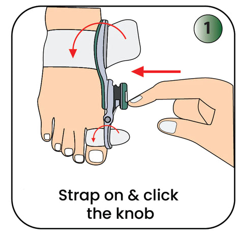 Bunion Corrector Splint step 1