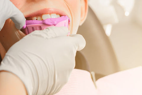 close-up of a dentist making an impression mold of a patient's teeth
