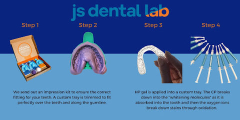 custom teeth whitening by JS Dental Lab