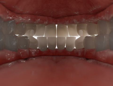 what is oral resting posture? (picture from inside a mouth)