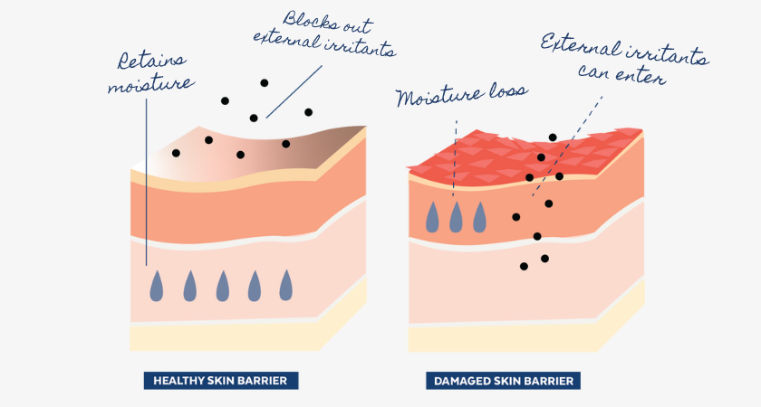 Damaged Skin Barrier and Healthy Skin Barrier, Replenish Ceramides + Blueberry Barrier Repair Serum