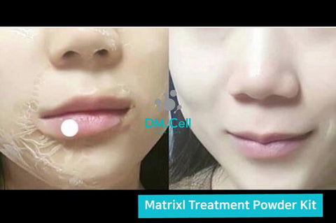 anti-wrinkle matrixl lifting treatment v-line program Korean skin care dm cell