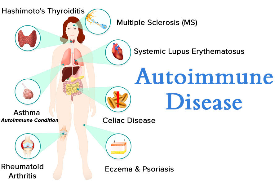 Autoimmune Disease Diagram