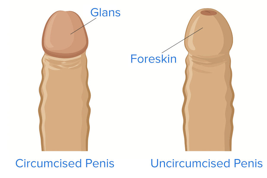Circumcision Diagram