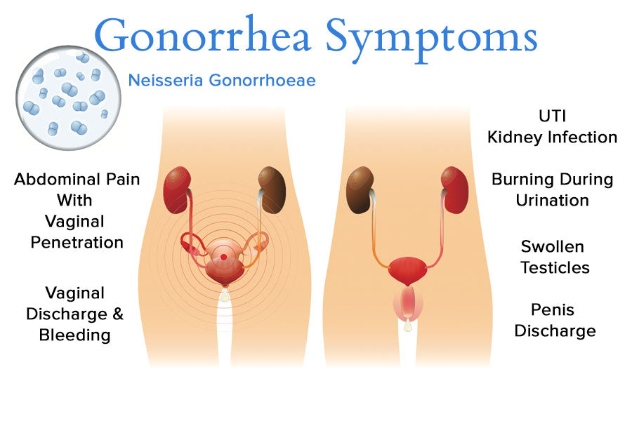 Gonorrhea Symptoms Diagram