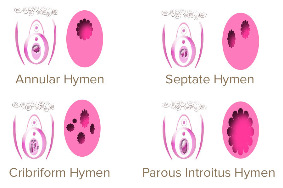 Diagram Of The Hymen