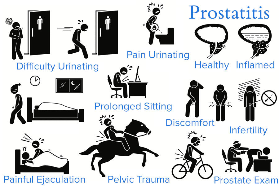 Prostatitis Diagram