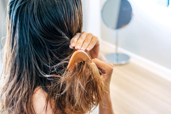 Can a Burning Scalp Lead to Hair Loss  AHS UAE