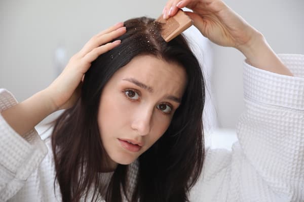 Dandruff Treatment