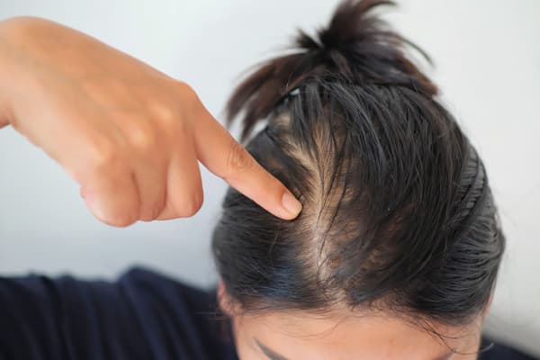 Common Hair Problems And Their Treatments – Vedix