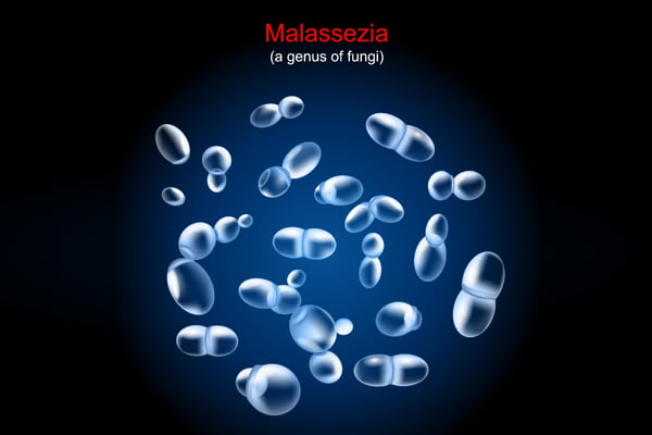 Malassezia